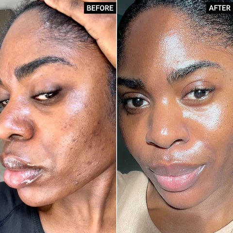 Radiant Glow Duo Peeling Kit™