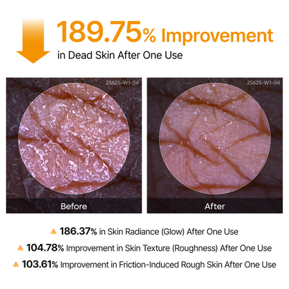 Peel Shot Keratin Care Kojic Acid Turmeric Spray VIP