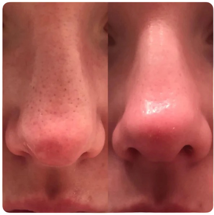 Dr. Melaxin I Offical Glass Skin Essential Kit (5 pcs)™