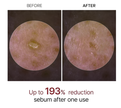 Dr. Melaxin Glow RiceGlass Skin Premium Kit (6 pcs)™