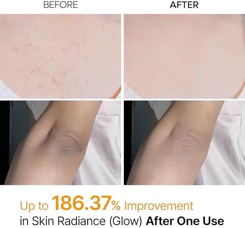 Glass Skin Renewal Kit (6 pcs) &trade;