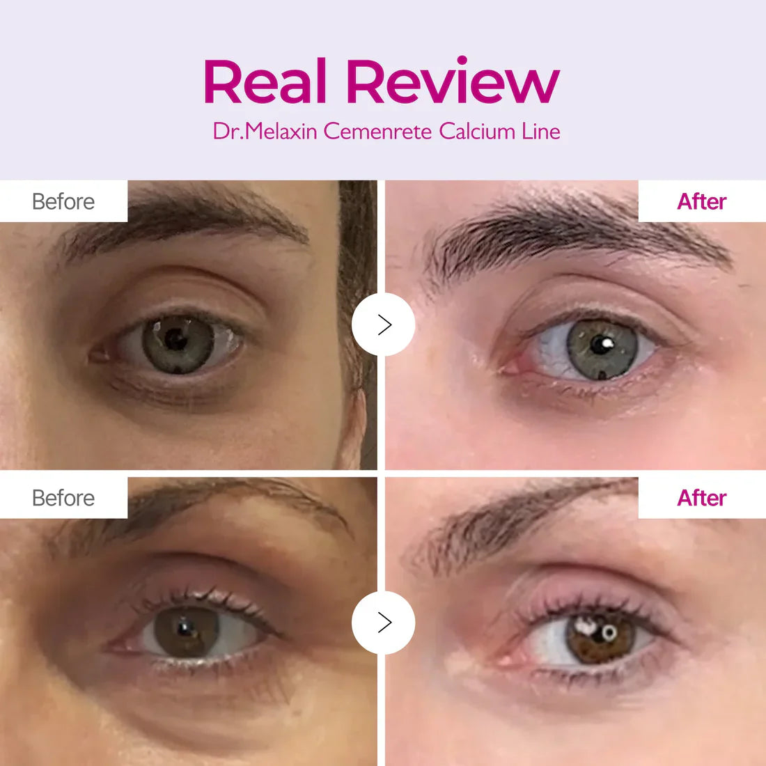 Radiant Skin Care Balm Set&trade;