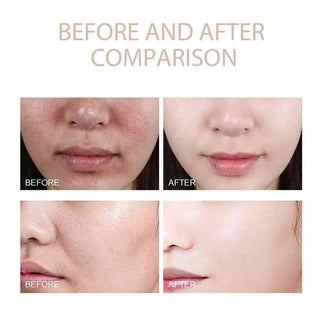 Dr. Melaxin Glow Rice Glass Skin Premium Kit (6 pcs)&trade;